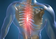 Osteochondrozė – viena iš aktualiausių XXI amžiaus judamojo aparatų ligų Osteochondroze