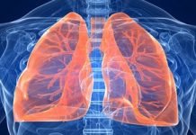 Kvėpavimo organų ligos ir slauga Kvėpavimo organų ligos ir slauga