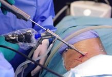 Pirmą kartą pasaulyje skilvelio aneurizmos gydymui pritaikyta minimaliai invazinė procedūra Pirmą kartą pasaulyje skilvelio aneurizmos gydymui pritaikyta minimaliai invazinė procedūra