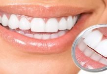 Sveiki dantys – laimingas jūs. Kaip pagerinti savo burnos higieną? odontologijos klinika