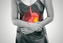 Padidėjęs skrandžio rūgštingumas – ką valgyti?